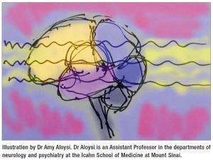 Brain Stimulation With ECT: Neuroscience Insights From an Old Treatment