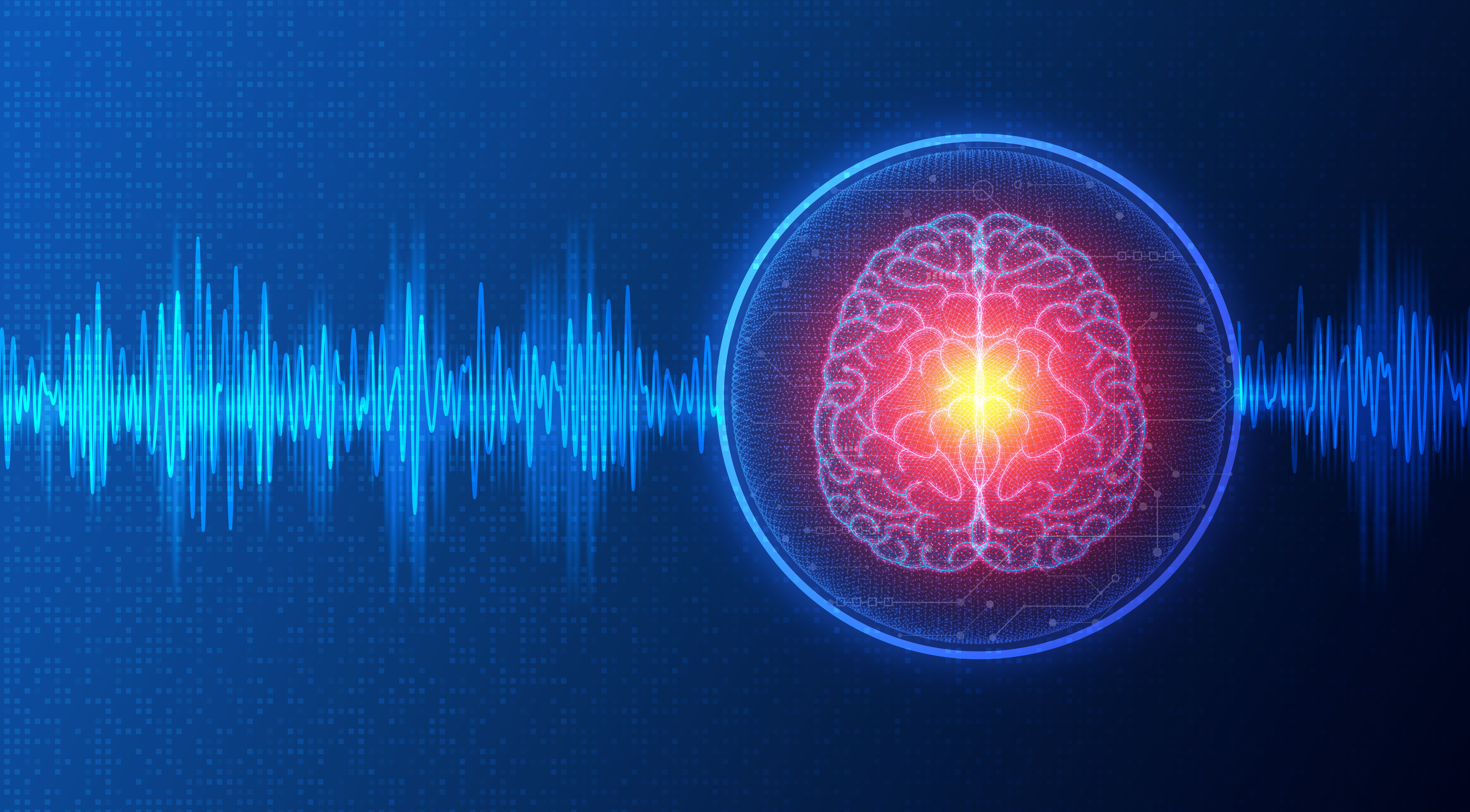 tDCS