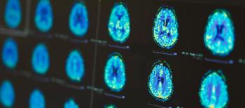 brain scan