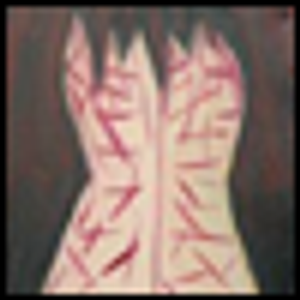Treating Self-Harm in Children and Adolescents