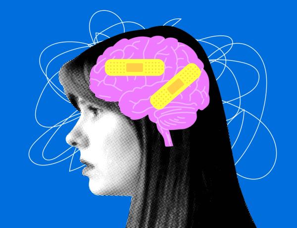 concussion