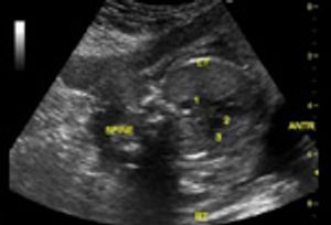 DailyDx: Can You Identify These Fetal Cardiac Structures?