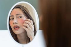 dermatitis depression inflammation