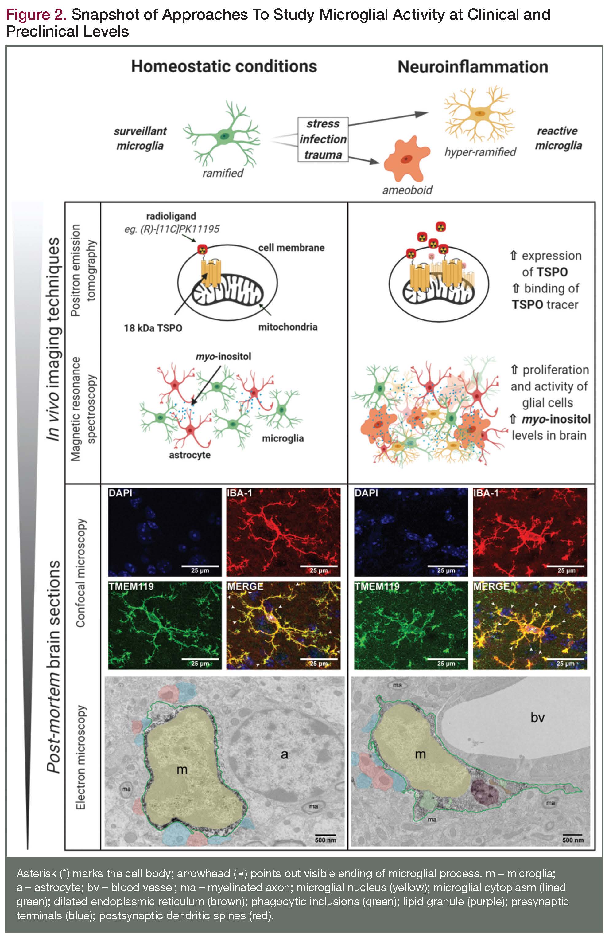 Microglial Involvement With Psychiatric Diseases