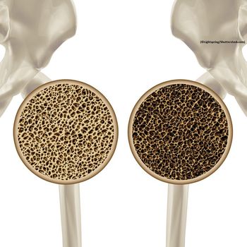 ©Lightspring/Shutterstock.com