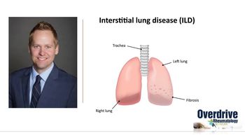 rheumatoid arthritis