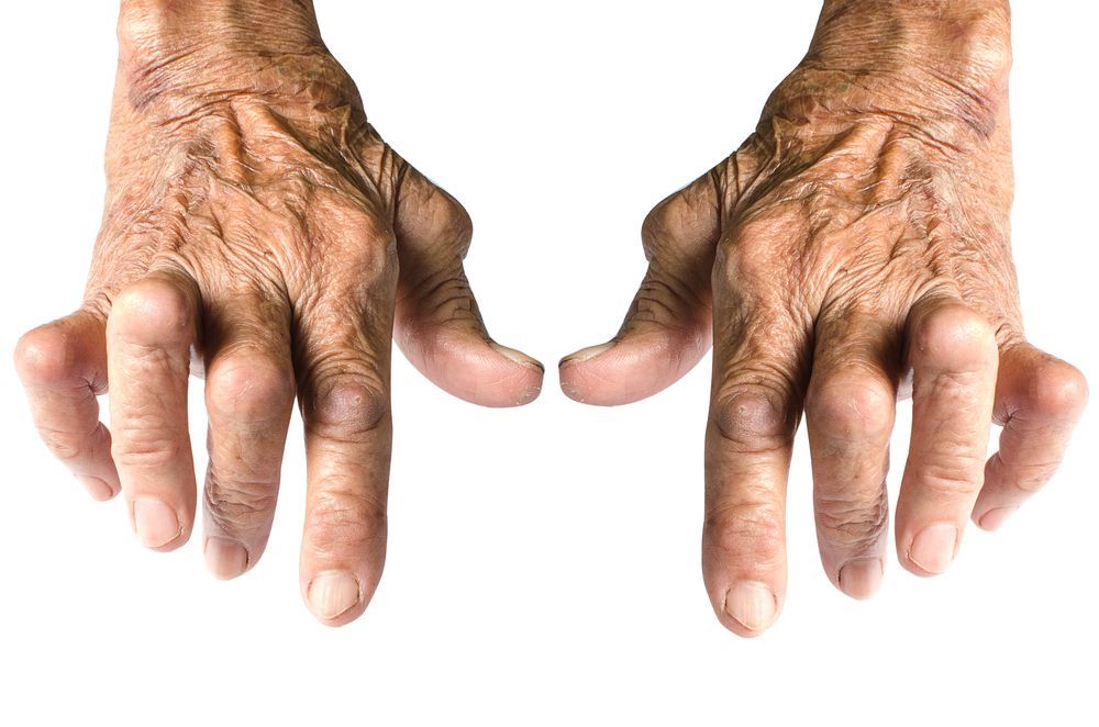 Arthritis (©ChaowalitSeeneha/Shutterstock.com)