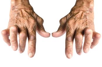 Arthritis (©ChaowalitSeeneha/Shutterstock.com)