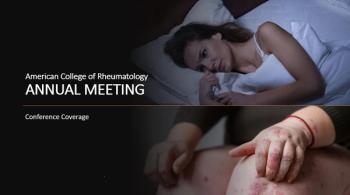 Secukinumab Improved Signs and Symptoms in Patients with Non-radiographic Axial Spondyloarthritis: Results from a Randomized Controlled Phase III Study Stratified by Baseline Objective Signs of Inflammation