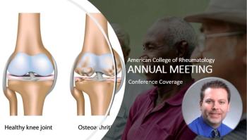 Osteoporosis Goes Underdiagnosed and Undertreated in Men