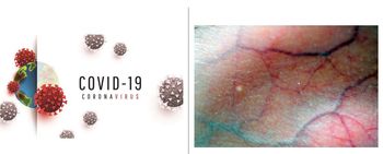 Vasculitis Patients Increasingly Avoid Doctor Visits During Pandemic