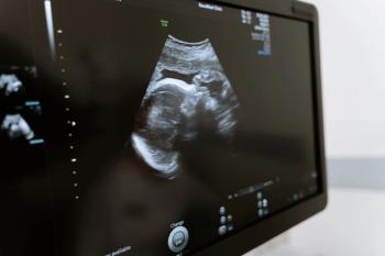 Fetus on an ultrasound | Credit: Pexels | Mart Production
