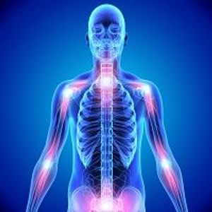 Plasma Exchange May Be Effective Treatment for CRPS