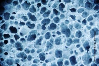 Additional Bone Traits Beyond BMD Help Assess Fracture Risk