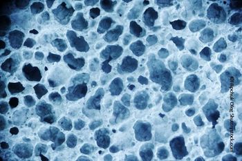 Additional Bone Traits Beyond BMD Help Assess Fracture Risk