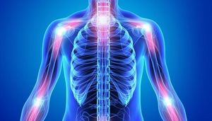 Cosentyx Stops or Lessens Psoriatic Arthritis Symptoms, Studies Show