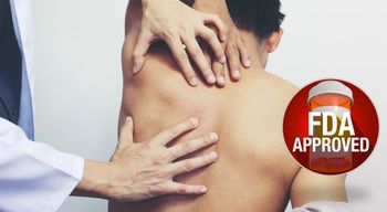 fda approved treatment for devic's disease