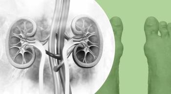 Allopurinol Doesn’t Slow Kidney Disease