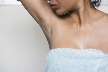 Is hidradenitis suppurativa a precursor to inflammatory arthritis?