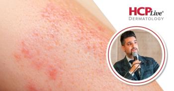 Bridging the Treatment Gap in Pediatric Psoriasis and PsA With Guselkumab, With Vimal H. Prajapati, MD