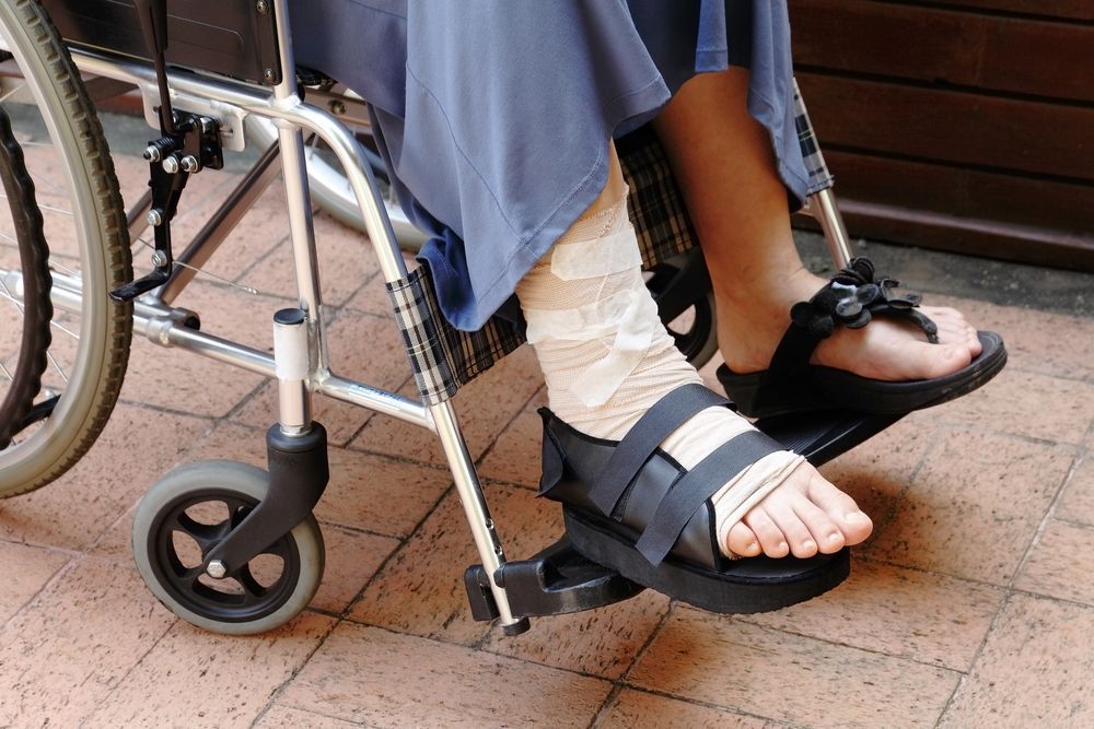 Fracture Risk is High in Lupus