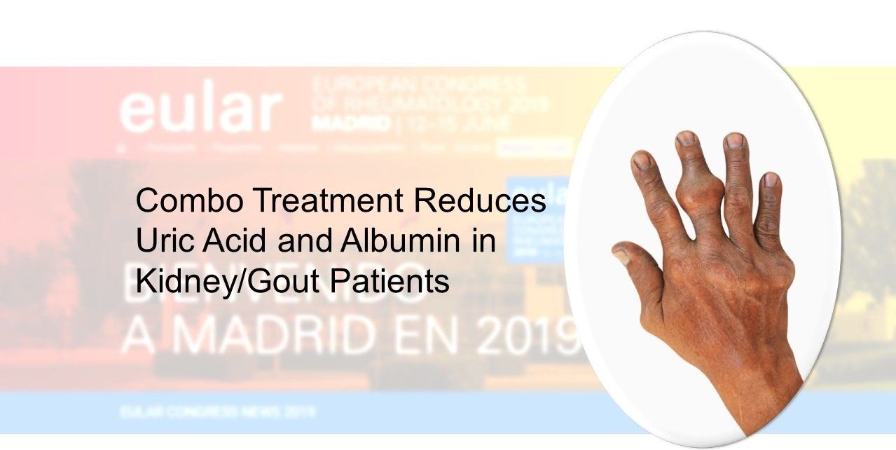 Hand and fingers with gout. (©SeneesriyotaShutterstock.com)