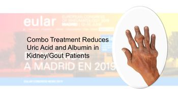 Hand and fingers with gout. (©SeneesriyotaShutterstock.com)