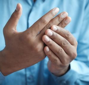  Rheumatoid arthritis | Credit: Unsplash