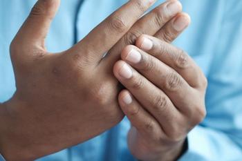 Person with rheumatoid arthritis with hand pain | Credit: UnSplash