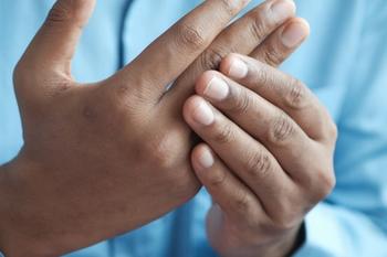 Rheumatoid arthritis | Credit: Unsplash