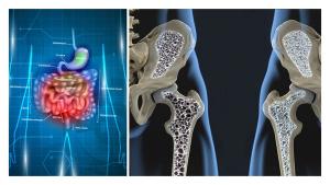 Probiotics Protect Against Lumbar Spine Bone Loss in Early Menopause