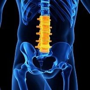Ankylosing Spondylitis Carries Vascular Risk