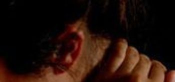 Fibromyalgia Common in People With IBD