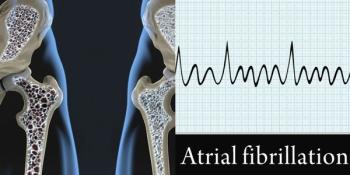 Examining the Risk Between Atrial Fibrillation and Bisphosphonates