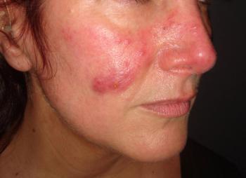 (MedicalIllustrations.com, 01AXX2P7) 