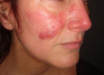 (MedicalIllustrations.com, 01AXX2P7)