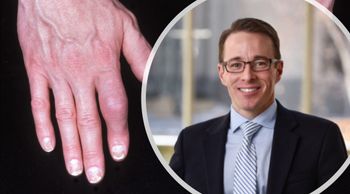 What pre-clinical signs should we look for to help diagnose psoriatic arthritis earlier?