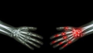 John Cush, MD: Rheumatology Year in Review