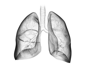 Could nitrogen-containing bisphosphonates protect against pneumonia?