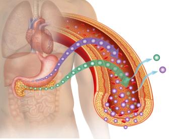 Insulin Resistance Linked to Rheumatoid Arthritis Flares