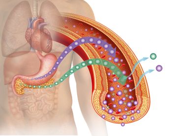 Insulin Resistance Linked to Rheumatoid Arthritis Flares