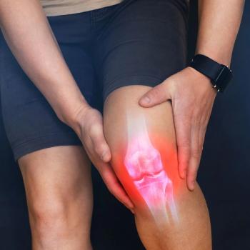 TNF-α, IL-17A Inhibitors Achieve Superior Arthritis, Skin Responses in PsA | Image Credit: Adobe Stock