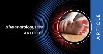 Firsekibart Beats Colchicine as Gout Flare Prophylaxis When Initiating ULT