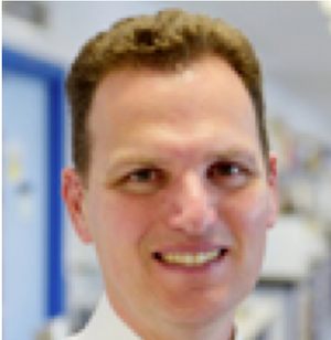 Upadacitinib Improved Psoriatic Arthritis Symptoms in Trial with Adalimumab