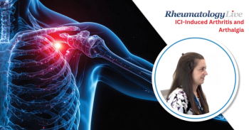 Model Predicts Persistent Arthritis After Checkpoint Inhibitor Therapy