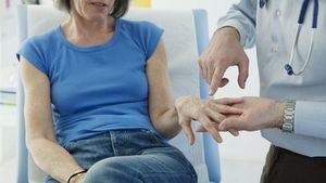 Allopurinol Use Linked to Lower Risk of First-Ever Coronary Event