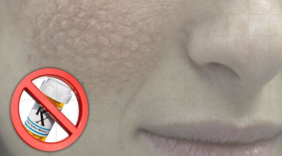 100 drugs that cause skin lupus