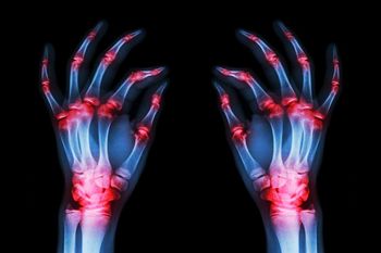 ©Puwadol-Jaturawutthichai/shutterstock.com