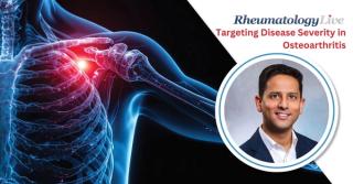 Pursuing Disease-Severity Targeting in Osteoarthritis, With Nitin Joshi, PhD