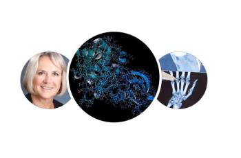 Rheumatology news roundup rheumatoid arthritis